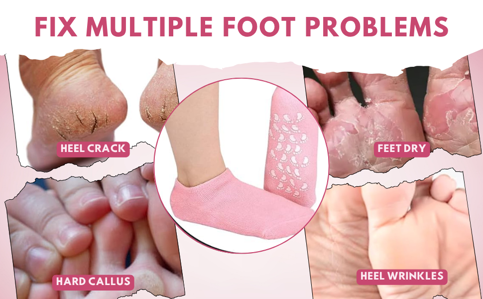 Moisturising Silicone Socks For Dry Cracked Heels